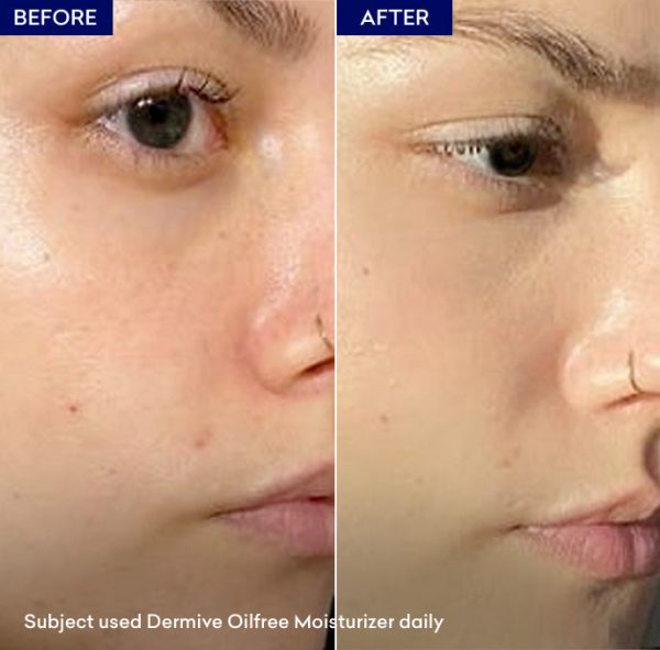 Dermive Oil-free Moisturizer